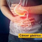 Su conocimiento y manejo de equipos de última tecnología lo convierten en un área fundamental para enfrentar una agresiva enfermedad como el cáncer en Clínica Medilaser Florencia. De esta forma describe la importancia de su trabajo. Cáncer gástrico en los jóvenes - www.tvnoticias.com.co endosonografía ecografía importancia cáncer radioterapia Medilaser S.A.S en el Surcolombiano Neiva