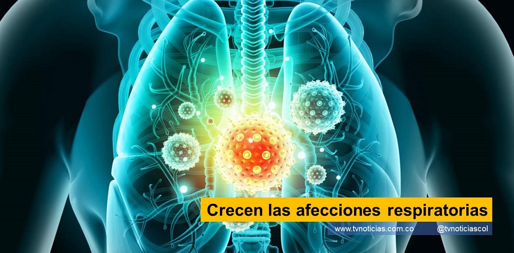 En Colombia, según el boletín epidemiológico, con corte al mes de julio de 2022, se  notificaron 3.686.927 consultas externa y de urgencias por Infecciones Respiratorias Agudas (IRA), lo que significa un incremento significativo pues, en abril del año en curso,  se presentaron 2.104.538 casos. Asimismo, se pudo observar un incremento de estos  casos en Antioquia, Atlántico, Barranquilla, Bogotá, Bolívar, Casanare, Chocó, Córdoba,  Cundinamarca, Guaviare, Santander, Santa Marta, Valle del Cauca, Vaupés y Vichada. Se  presenta disminución en Amazonas, Buenaventura y Huila Tras la continuidad de la ola invernal en el país, las diferentes entidades de salud  prenden las alarmas y hacen un llamado a la población en general para estar atentos a  las distintas enfermedades relacionado a las lluvias y bajas temperaturas, como las  infecciones respiratorias, gripas o refriados Crecen las afecciones respiratorias tvnoticiascol www.tvnoticias.com.co