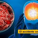 La atención del Accidente Cerebrovascular ACV representa un desafío para el sistema de salud colombiano y por eso es prioridad para este sector del país. El accidente cerebrovascular - www.tvnoticias.com.co tvnoticiascol salud EPS IPS Colombia